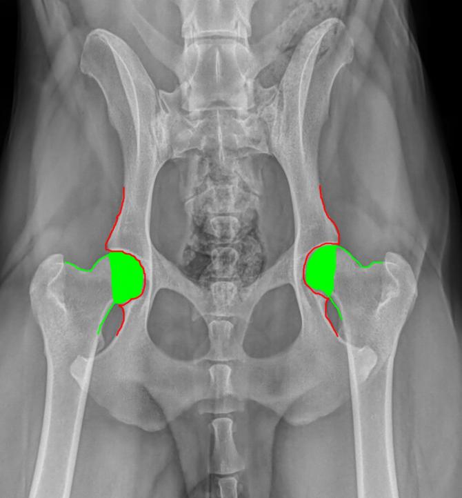 normal-hips-rads-graphics